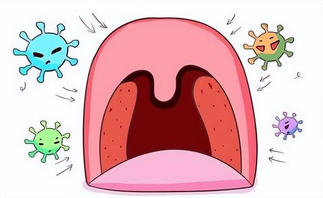 经常扁桃体发炎怎么办？这些原因都易引起发炎！出现症状及时就医(图5)